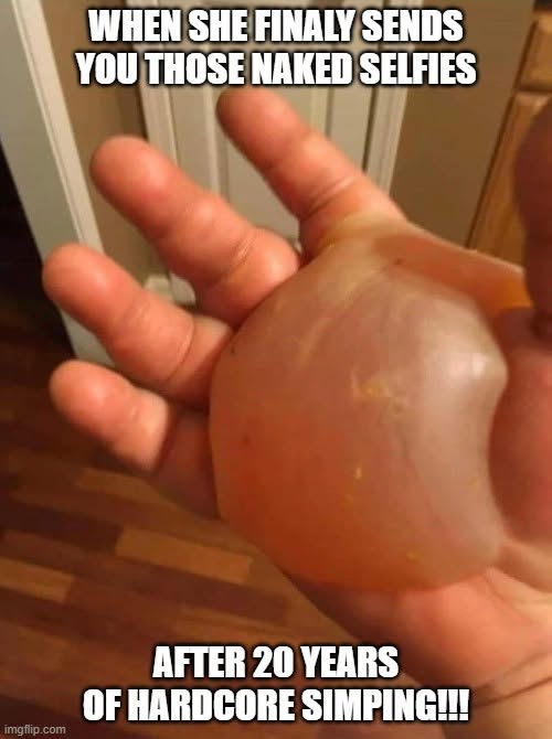 Beta Male Memes, Cringe Memes, Dating Memes, Friend Zone Memes, Funniest Memes, Horny Memes, Masterbation Memes, NSFW, Nudes Memes, Relationship Memes, Selfie Memes, Sex Memes, Thirsty Memes, The meme shows a close-up of a person’s hand with a huge, swollen, blister-like bulge covering much of the palm, making the hand look painfully overused and cartoonishly damaged. The bold white Impact-style caption at the top reads, “WHEN SHE FINALY SENDS YOU THOSE NAKED SELFIES,” while the bottom finishes the joke with, “AFTER 20 YEARS OF HARDCORE SIMPING!!!”